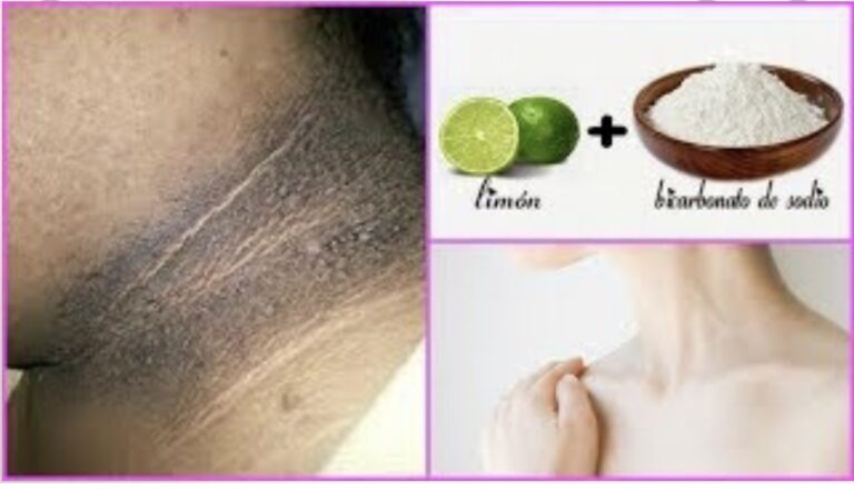 Cuello oscuro: remedio casero con bicarbonato, limón y agua