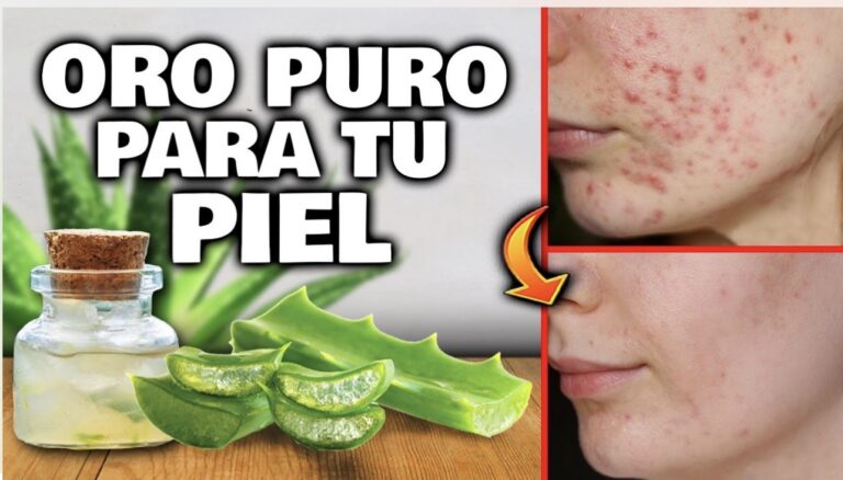 Sábila para la piel: beneficios y cómo aplicarla correctamente