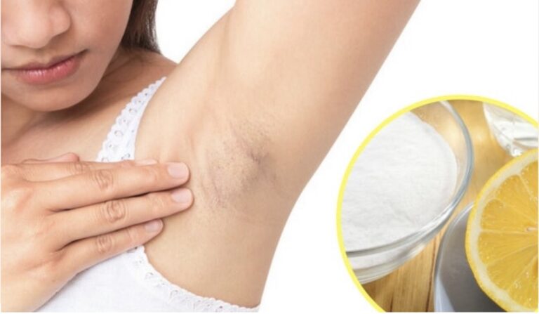 Remedio casero para aclarar axilas naturalmente