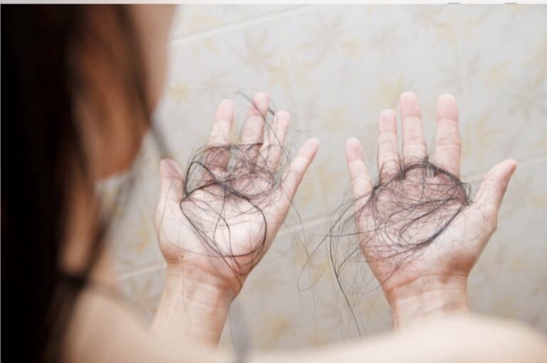 Caída del cabello: causas y remedio natural