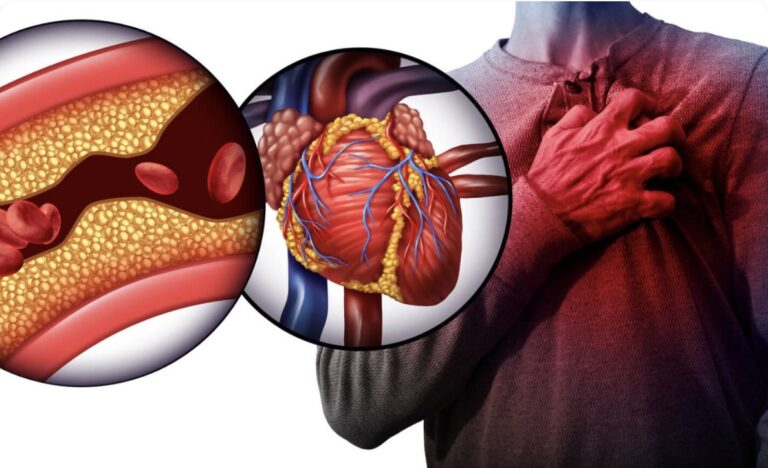Colesterol alto: soluciones naturales que pueden apoyar tu salud y el equilibrio de tu cuerpo