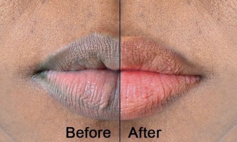 Remolacha y miel para labios oscuros: remedio natural para un tono más rosado y saludable
